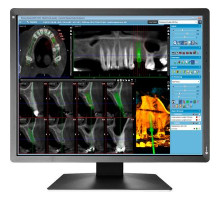 Монитор Eizo MX216-SB