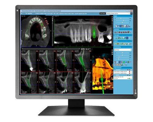 Монитор Eizo MX216-SB